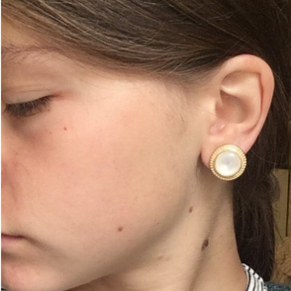 Vintage Round Cat Eye Opal Stud Earrings - Picture 2 of 5